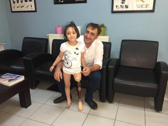 Babasının yaptığı protez bacakla gündeme gelmişti... Minik Özge'den haber var!