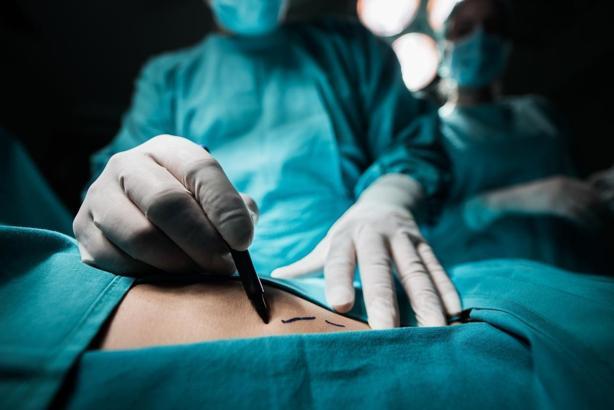 Spinal anestezi nedir? Nasıl yapılır? Spinal anestezi ile doğum nasıl olur?