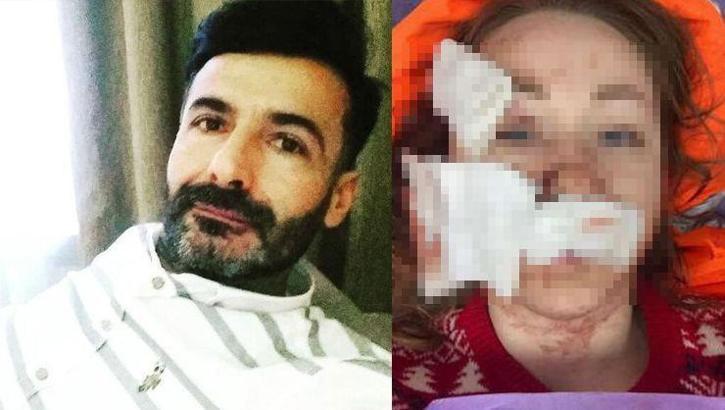 Eşinin yüzünü falçatayla kesen adam hala öldürmekle tehdit ediyor