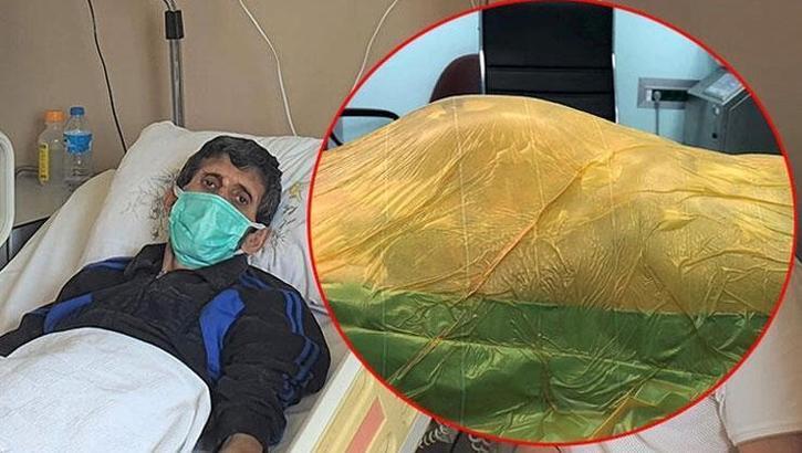 Karnındaki 'saatli bomba' 4 yıl içinde büyüdü! Doktorlar bile inanamadı