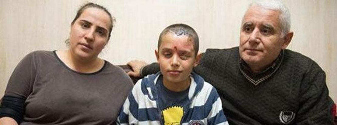 Deney kurban&#x131; Mert yard&#x131;m bekliyor