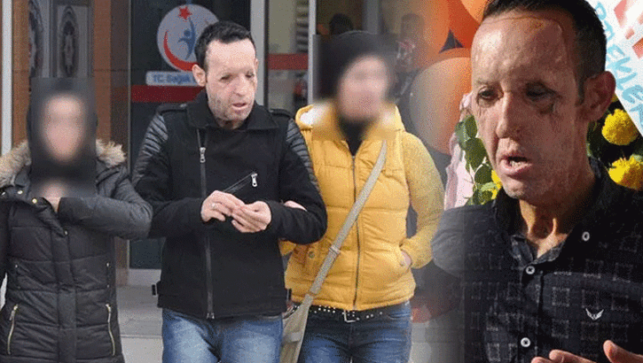 Yüz nakli yapılan Recep Sert gözaltına alındı