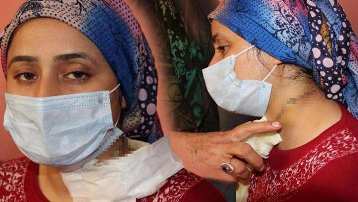 Eşinin boğazını falçatayla kesmişti... Cani kocaya 'iyi hal' indirimi!