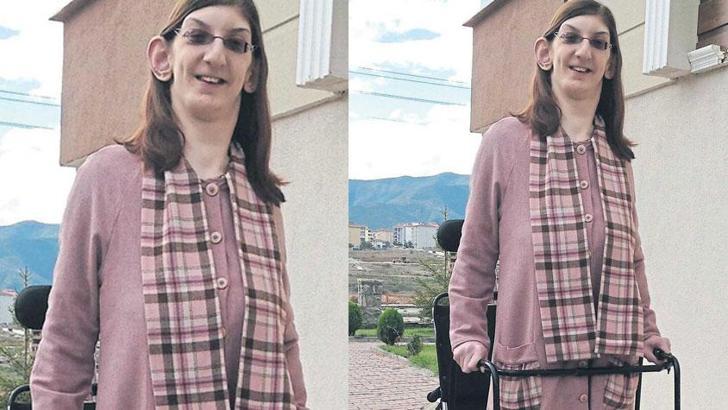Rumeysa Gelgi: Sıra dışı fiziksel özelliklerle dünyaya geldim ve bunun kutlanmasını istiyorum