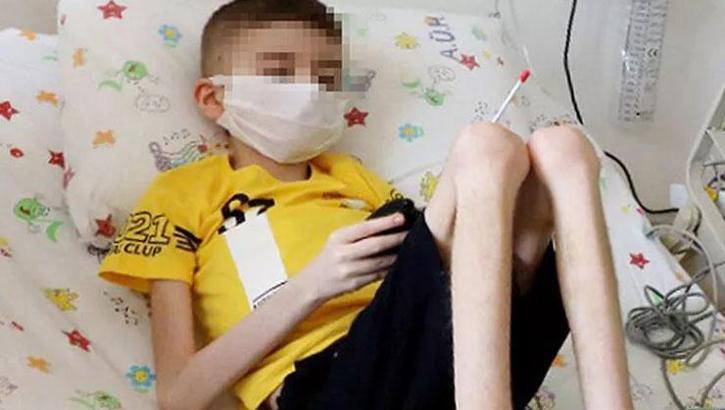 Çöp evde bulunan Cem'den iyi haber! 3 kilo daha aldı
