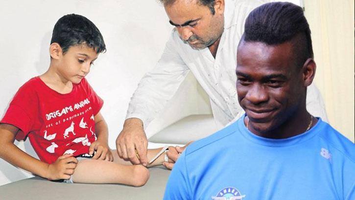 Bekle beni Balotelli! Küçük Muhammed protezine kavuşuyor