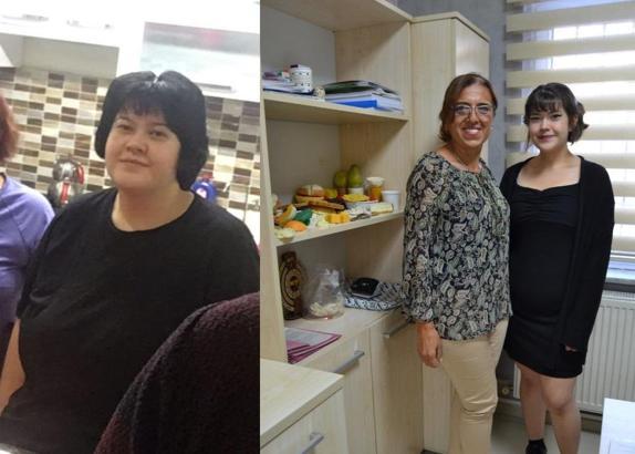 Ameliyat olmadan 50 kilo vermeyi başardı!