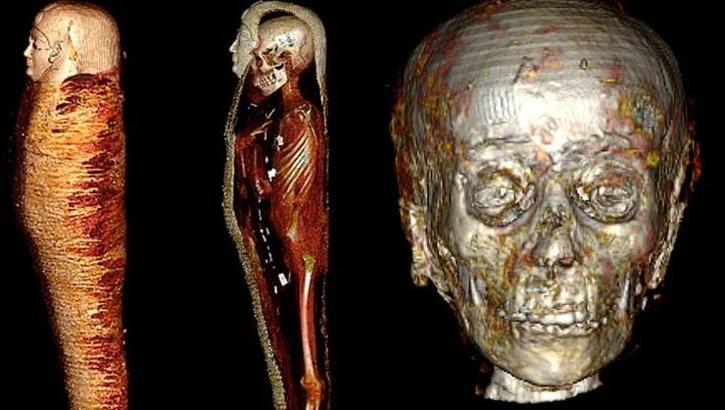 Gizem tomografiyle çözüldü! Hepsi Altın Çocuk'tan çıktı, tam 49 tane