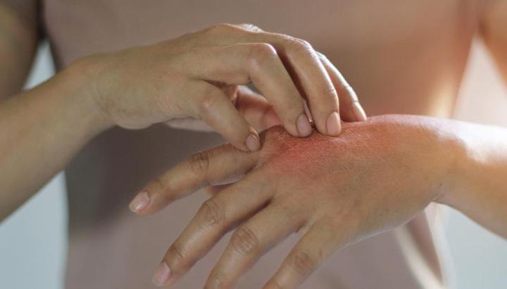 Vücut kuruluğu neden olur? İşte vücut kuruluğunu önlemek için alınabilecek önlemler...