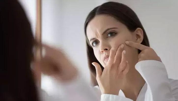 CİLT KURULUĞUNA İYİ GELEN DOĞAL ÜRÜNLER NELERDİR? HANGİ YAĞLAR CİLT KURULUĞUNU GİDERİR?