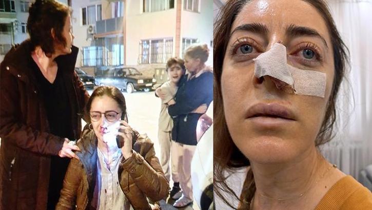 Kocasının sevgilisi sandığı kadına dehşeti yaşattı! Başını otomobilin kapısına sıkıştırdı