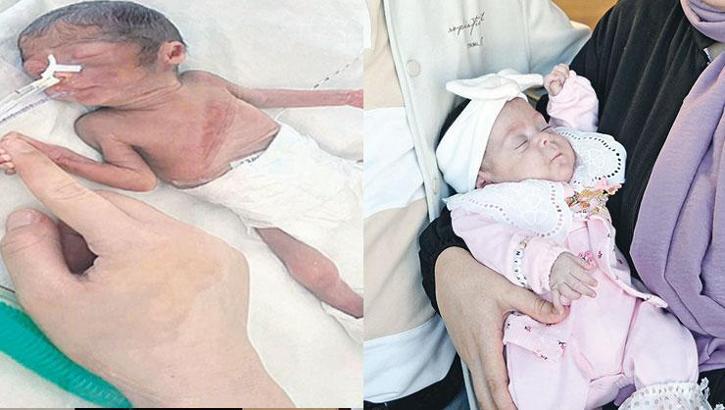 Mucize bebek