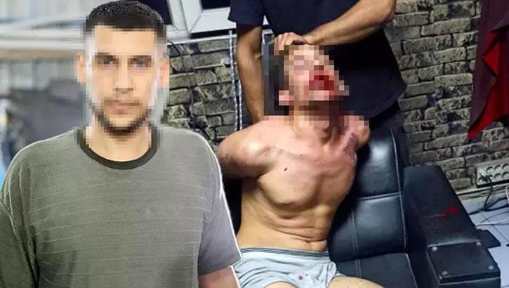 Dişleri kırılıp, hamam böceği yedirildi! 3 günlük işkencede şok rapor