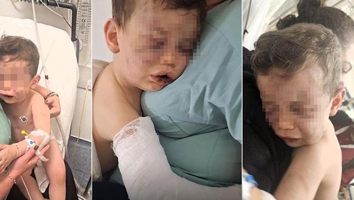 2 yaşındaki çocuk dehşeti yaşadı! Annesinin sevgilisi öldüresiye dövdü