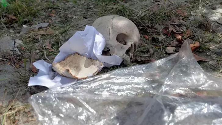 Çöpte kafatası bulundu! Bir çocuğa ait olabilir