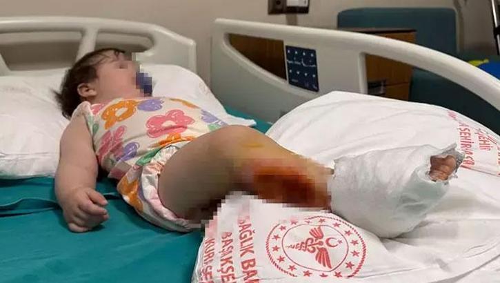 1 yaşındaki bebek, babaannesinin gözü önünde dehşeti yaşadı!
