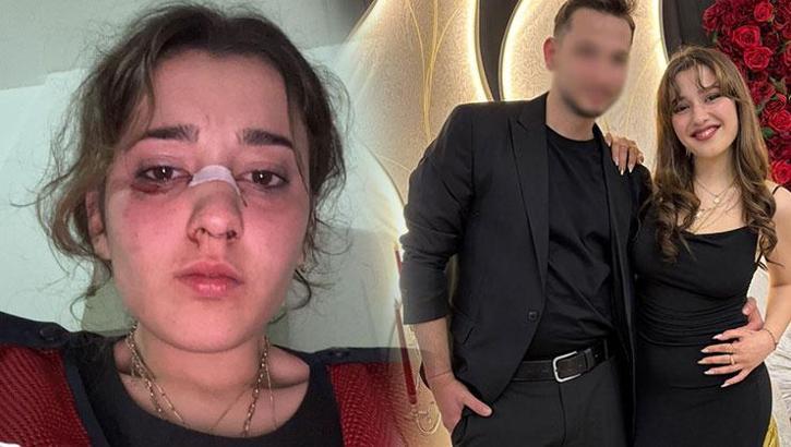 Nişanlısıyla çıktığı tatilde kabusu yaşadı! Kanlar içinde kaldı... 'Asla geri dönmeyeceğim'
