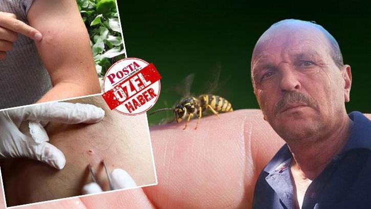 İlk 30 dakika kritik önemde! Uzmanlar belirtilere karşı uyardı: Arı deyip geçmeyin, sadece bir tanesi öldürmeye yetti
