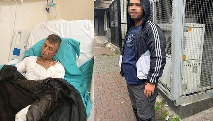 Engelli vatandaş dehşeti yaşadı! Telefonunu çaldı, şikayet edince benzin döküp yaktı