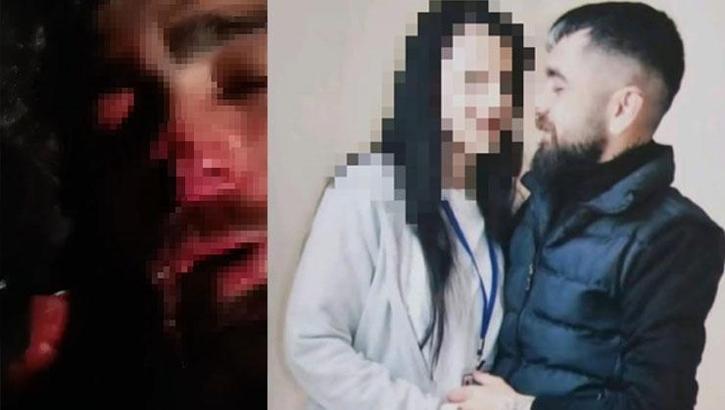 Evli kadın, eski sevgilisine işkence yaptırdı! Kulağı ve burnu koparıldı