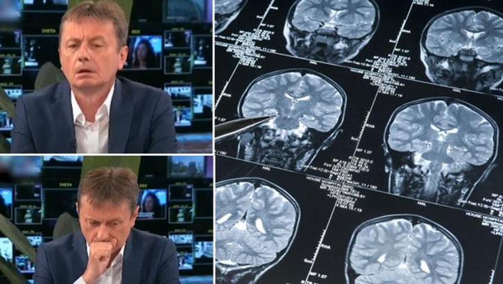 Canlı yayında korku dolu dakikalar! Kameralar karşısında beyin kanaması geçirdi