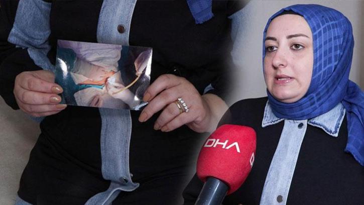 Doğum yapan kadının karnında 15 cm'lik hortum unuttular! Doktorun skandal savunması şoke etti