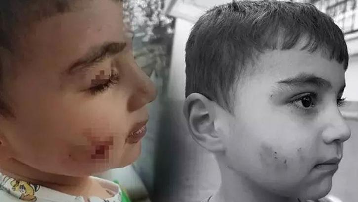 Ankara'da dehşet: Evinde uyuyan çocuğu lağım faresi ısırdı