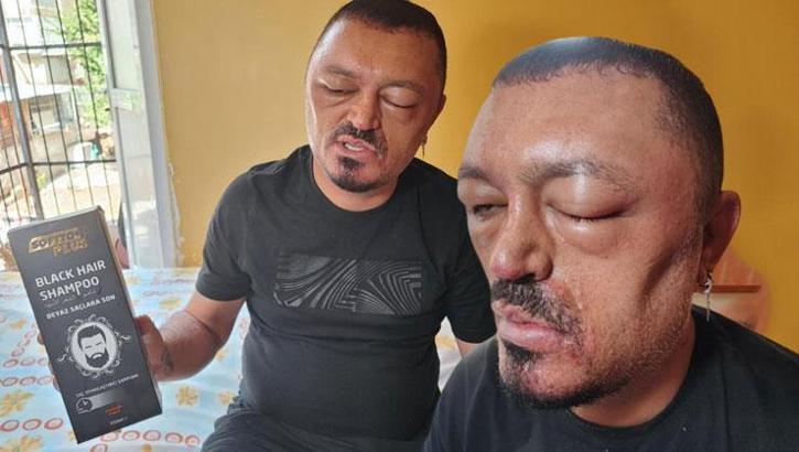 Berberi önerdi diye aldı, 48 saat sonra hayatı kabusa döndü!