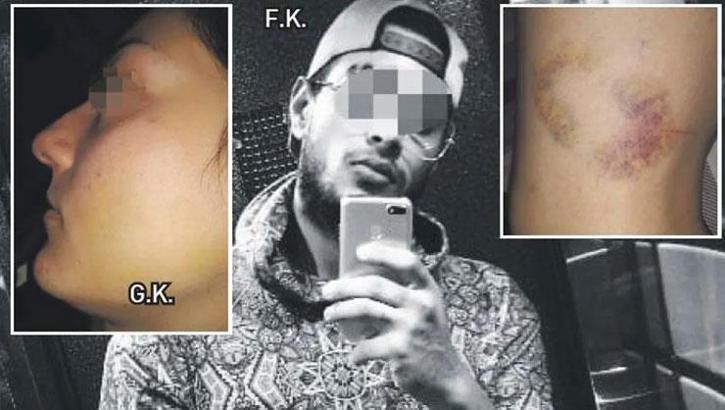 Şiddet gören kadına mahkmeden şok karar! Kıskançlığı 'kusur' sayıldı