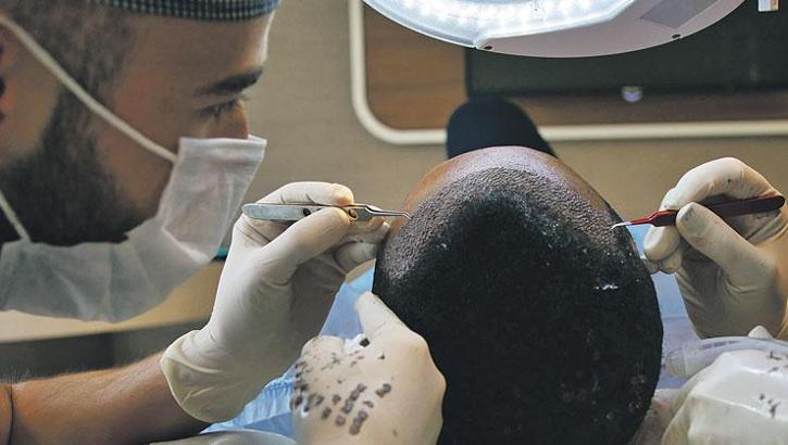 Saç ekimini yabancıya öğretip sağlık turizmini baltalıyorlar