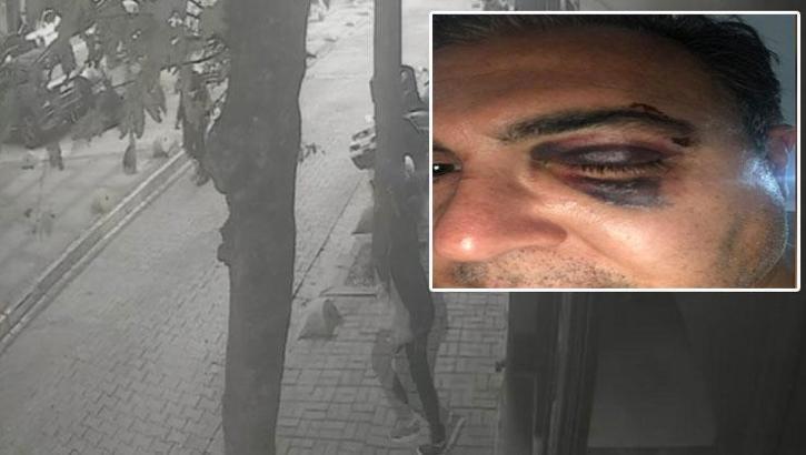 Bakırköy’de kedi besleyen iş insanına ‘yolu kapattın’ dayağı