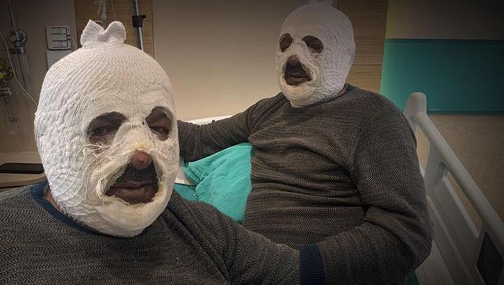 Arkadaşına iyilik yapmak isterken ibretlik oldu! 'Ben yandım kimse yanmasın'