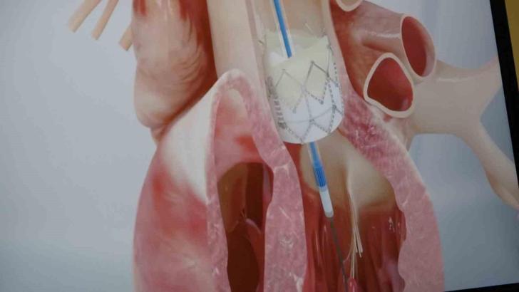 Genç yaştaki ani ölümlerde korkutan gerçek: Yüzde 90’ı bu sebepten kaynaklanıyor