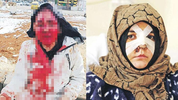 Nazlı’nın çığlığını duyun!