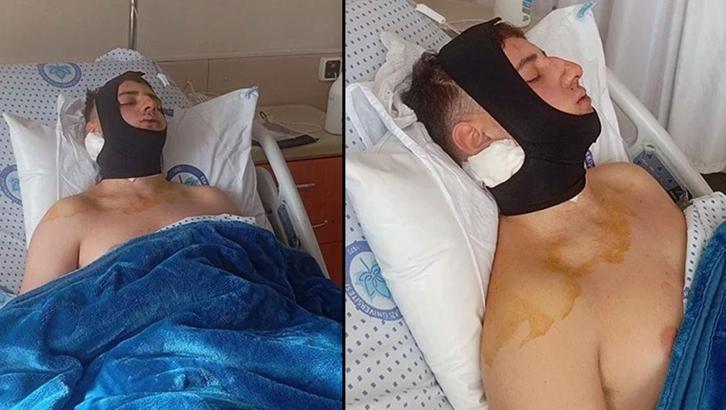 Darbettikleri öğrencinin omuriliğini ve çenesini kıran 4 şüpheli tutuklandı