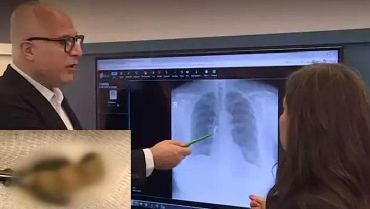 Uyandığında şoke oldu! Dişlerini yuttuğunu düşündü, gerçek röntgende ortaya çıktı