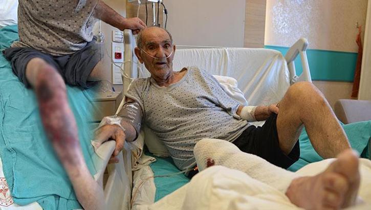 Lavabo açıcı faciası: Tıkanan gidere döktüğü kimyasal bacağını yaktı