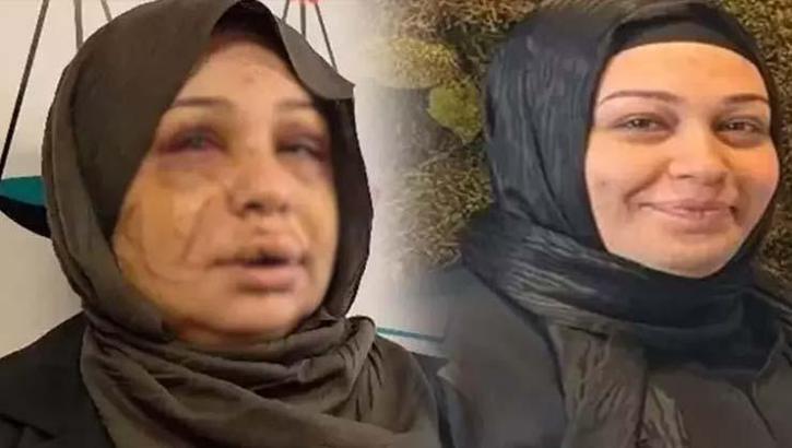 Jiletli saldırıya ağır ceza yolu