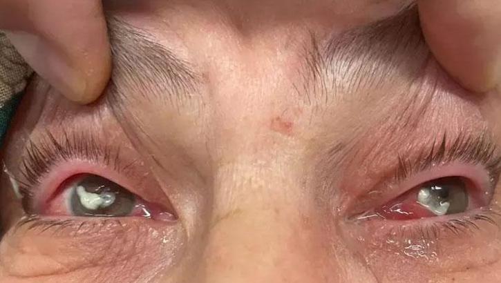 Gözlükten kurtulmak isterken kör oluyordu! Sosyal medya tuzağına düştü