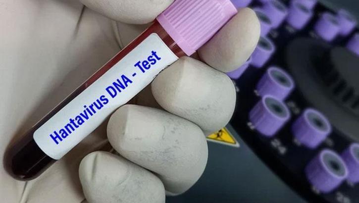 DSÖ'den hantavirüs açıklaması: Vaka sayısı artabilir