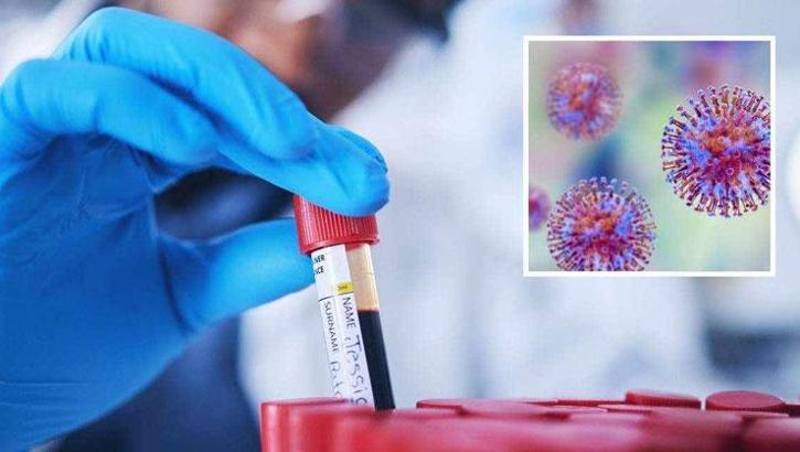 Laboratuvardan kaçırdılar! 113 adet tüpte virüs ve insan DNA'sı: 'Kendilerini kanundan üstün gördüler'