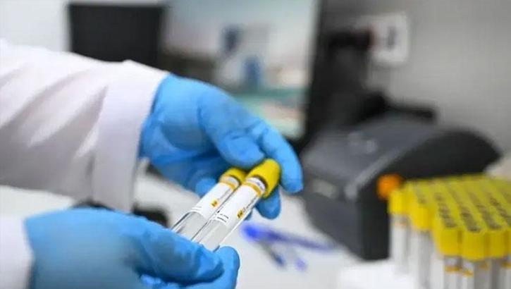 Keçiören Belediyesi'nde 171 personelin uyuşturucu tarama testi pozitif çıktı