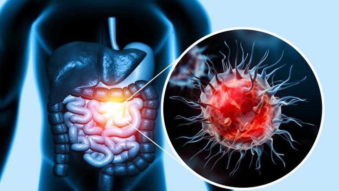 Az miktarda tüketilen meyve ve sebze kolorektal kansere davetiye çıkartabilir!