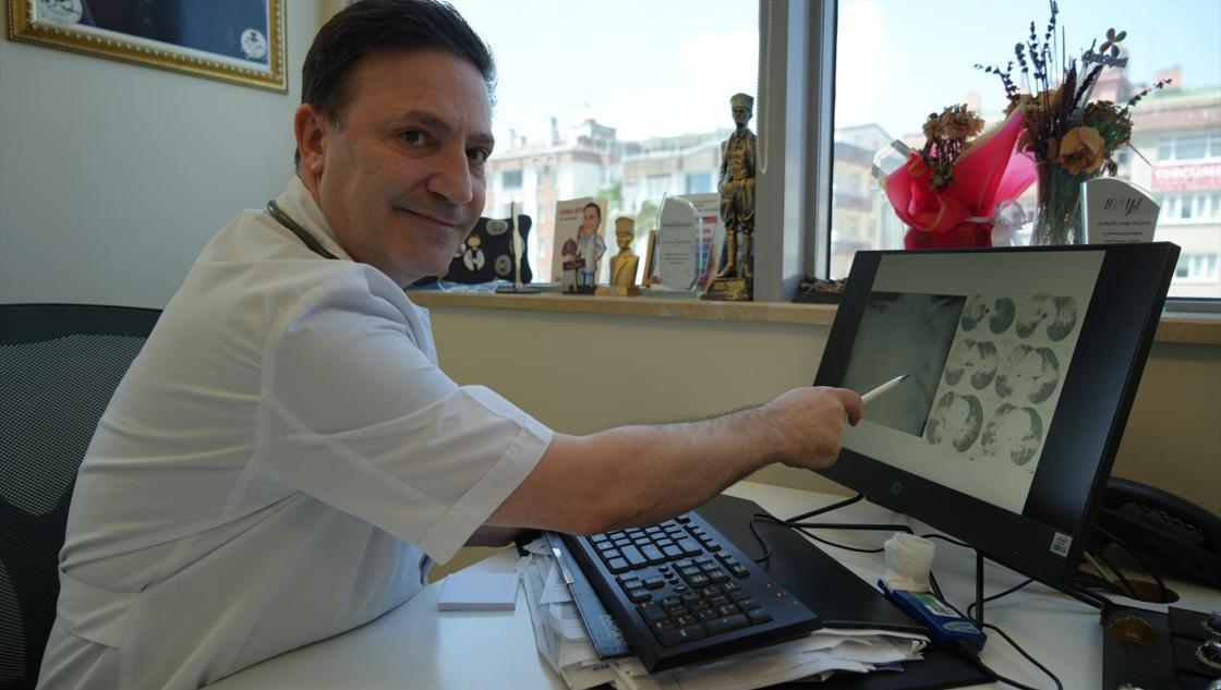 Uzmandan hantavirüs değerlendirmesi! “Salgın riski düşük”