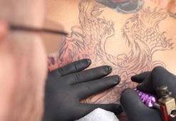 PicoSil ile istenmeyen leke ve dövmelere son!