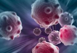 1 milyon hücrenin arasından tümörlü olanı buluyor