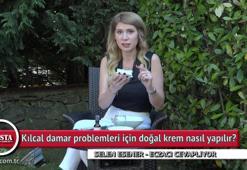 Kılcal damar problemleri için doğal krem nasıl yapılır?