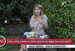 Sivilce lekeleri için doğal krem nasıl yapılır?