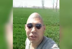 Bu adamın kafası yumurtaya benziyor