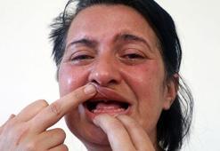 32 dişi çekildikten sonra acıdan ötanazi isteyen kadın devayı Gülhane'de buldu